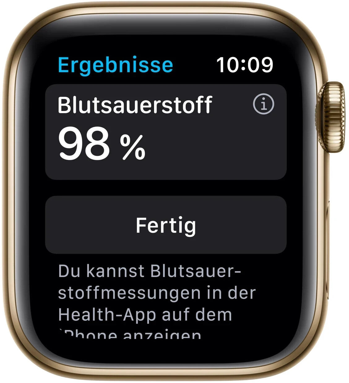 Watch 6 LTE Gold Alu 40mm MJXM3F